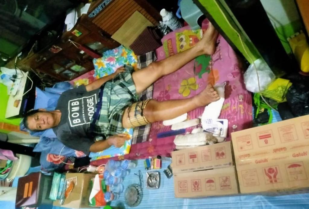 Menabrak Warga Sedang Beristirahat di Pinggir Jalan Hingga Patah Kaki, Oknum Polisi Polda Kalsel Diduga Tak Bertanggung Jawab