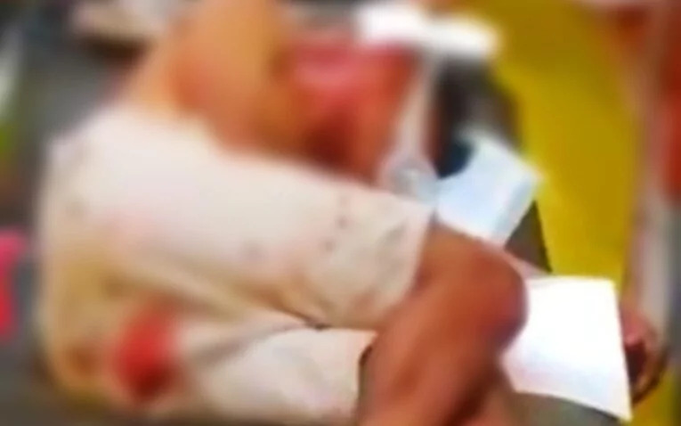 Diserang Mandau dari Orang tak Dikenal, Pria di Kelumpang Hulu Luka Parah