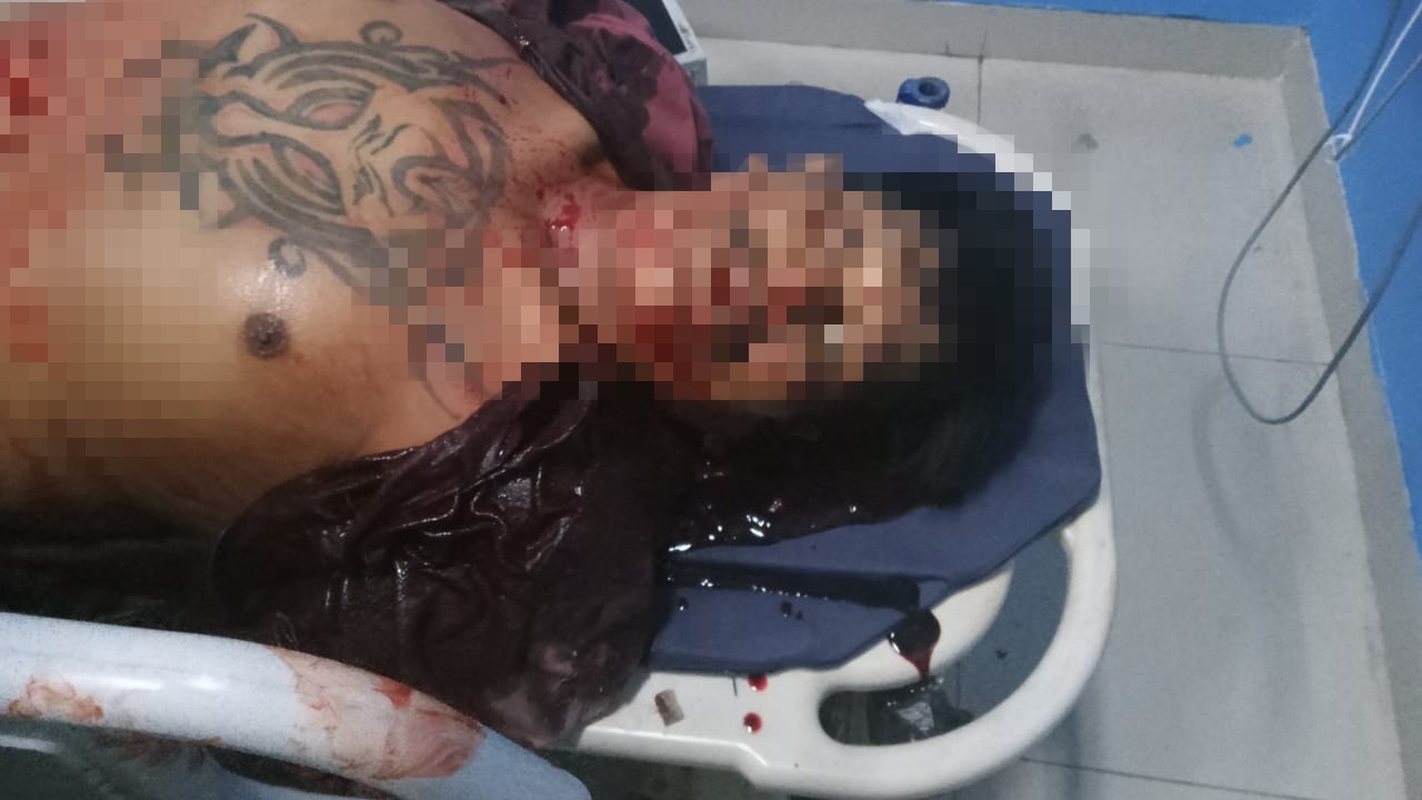 Pria Ditemukan Tewas Bersimbah Darah, Diduga Akibat Perkelahian