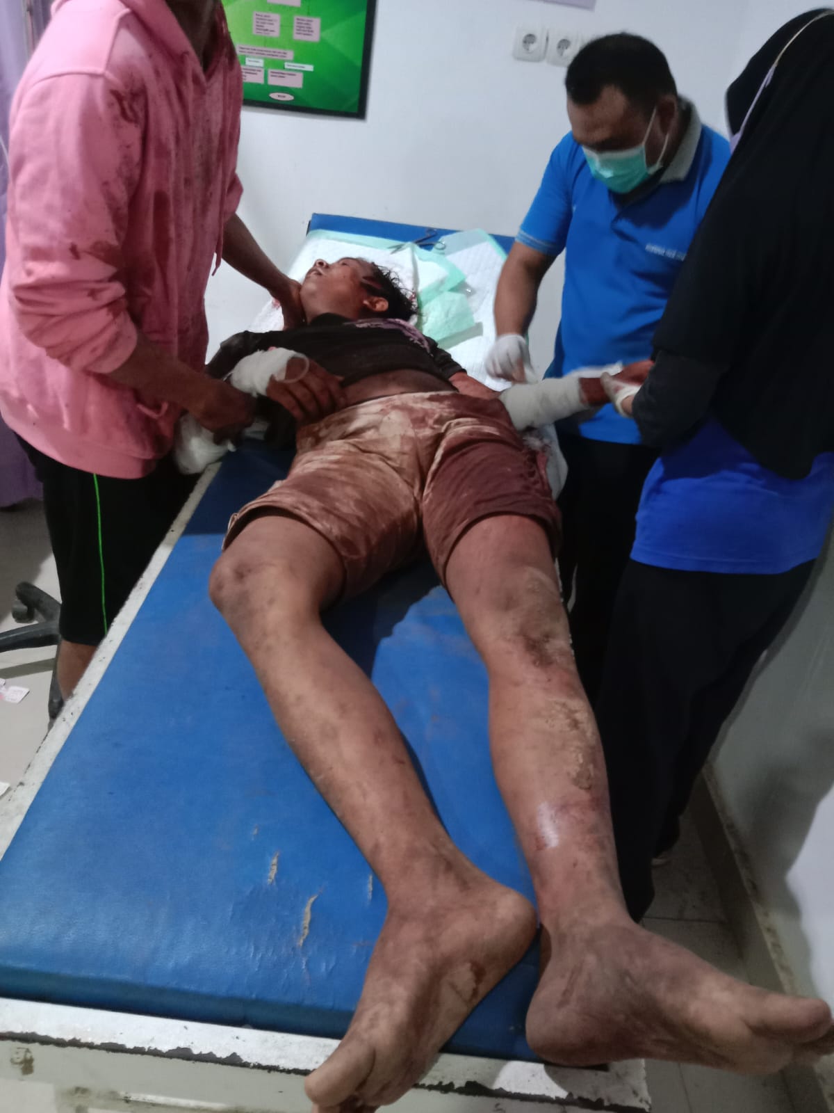 Tegur Pemotor yang Menggeber Motor Depan Warung di Teluk Kepayang, Robi Asidik Dibacok hingga Luka Parah