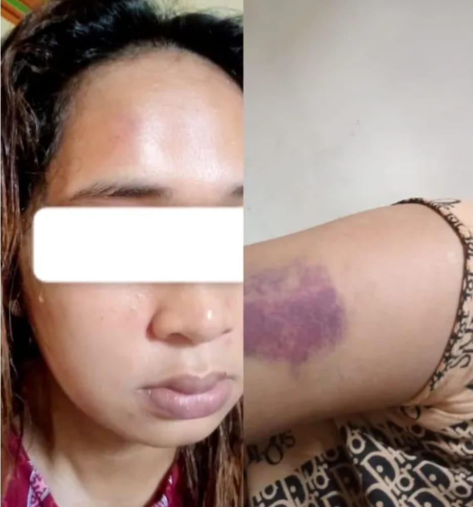 Parah ! Hanya karena Ayam Goreng, Suami di Teluk Kepayang Injak injak Istrinya