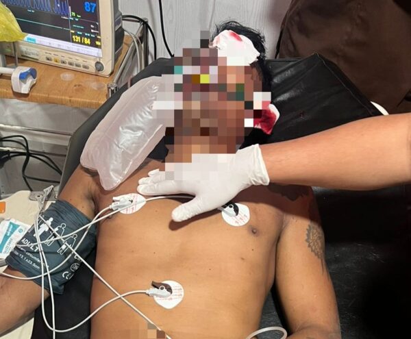 Seorang Wakar Ditikam Disela Pesta Miras