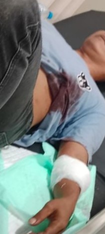 Gegara tak Sabar Naik Mobil, Berakhir Penikaman