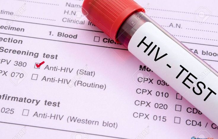 Banjarbaru Terbanyak Kedua Kasus HIV di Kalsel, Deteksi Dini Dinilai Menyelamatkan