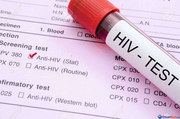 Banjarbaru Terbanyak Kedua Kasus HIV di Kalsel, Deteksi Dini Dinilai Menyelamatkan