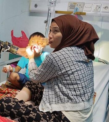 Belasan Anak Operasi Bibir Sumbing Gratis
